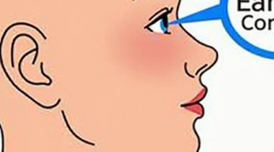 what-does-a-lump-on-your-earlobe-mean-causes-and-what-to-do